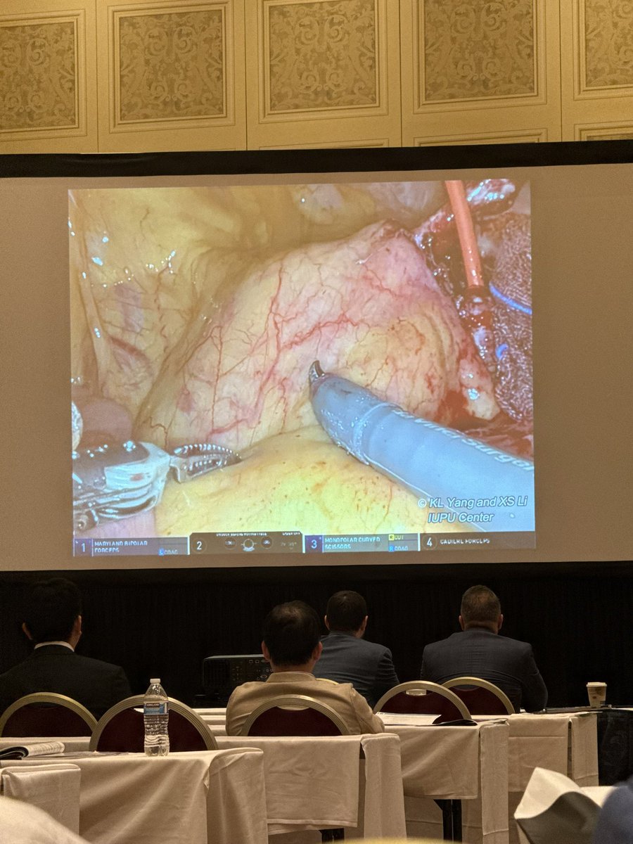 Great talks &amp; learning this morning with <a href="/SocietyGURS/">GURS</a>: 
⭐️ Renal trauma: excretory imaging is key, ideal time is 9 mins
⭐️ Ureteral reimplants: tunneling with 5:1 ratio, with strictures consider cancer
⭐️ Renal pelvis flaps for proximal strictures 
⭐️ SOO many awesome videos