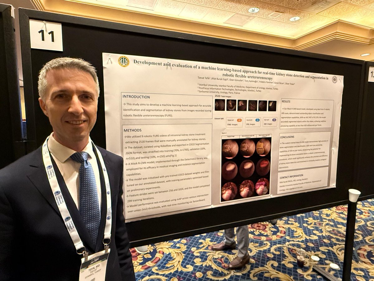 Tzevat TEFIK (@tzevattefik) on Twitter photo Thank you for great moderation/ Q&As
<a href="/roger_sur/">Roger Sur</a>
<a href="/AjhungMD/">Andrew J. Hung, MD</a>
& questions of all attendees
The study was chosen for a #AUA25 <a href="/urotoday/">UroToday.com</a> highlight.
You may check the details shortly
👇
urotoday.com/conference-hig…
#RoboticsInEndourology #AIEndourology Thank you for great moderation/ Q&As
<a href="/roger_sur/">Roger Sur</a>
<a href="/AjhungMD/">Andrew J. Hung, MD</a>
& questions of all attendees
The study was chosen for a #AUA25 <a href="/urotoday/">UroToday.com</a> highlight.
You may check the details shortly
👇
urotoday.com/conference-hig…
#RoboticsInEndourology #AIEndourology