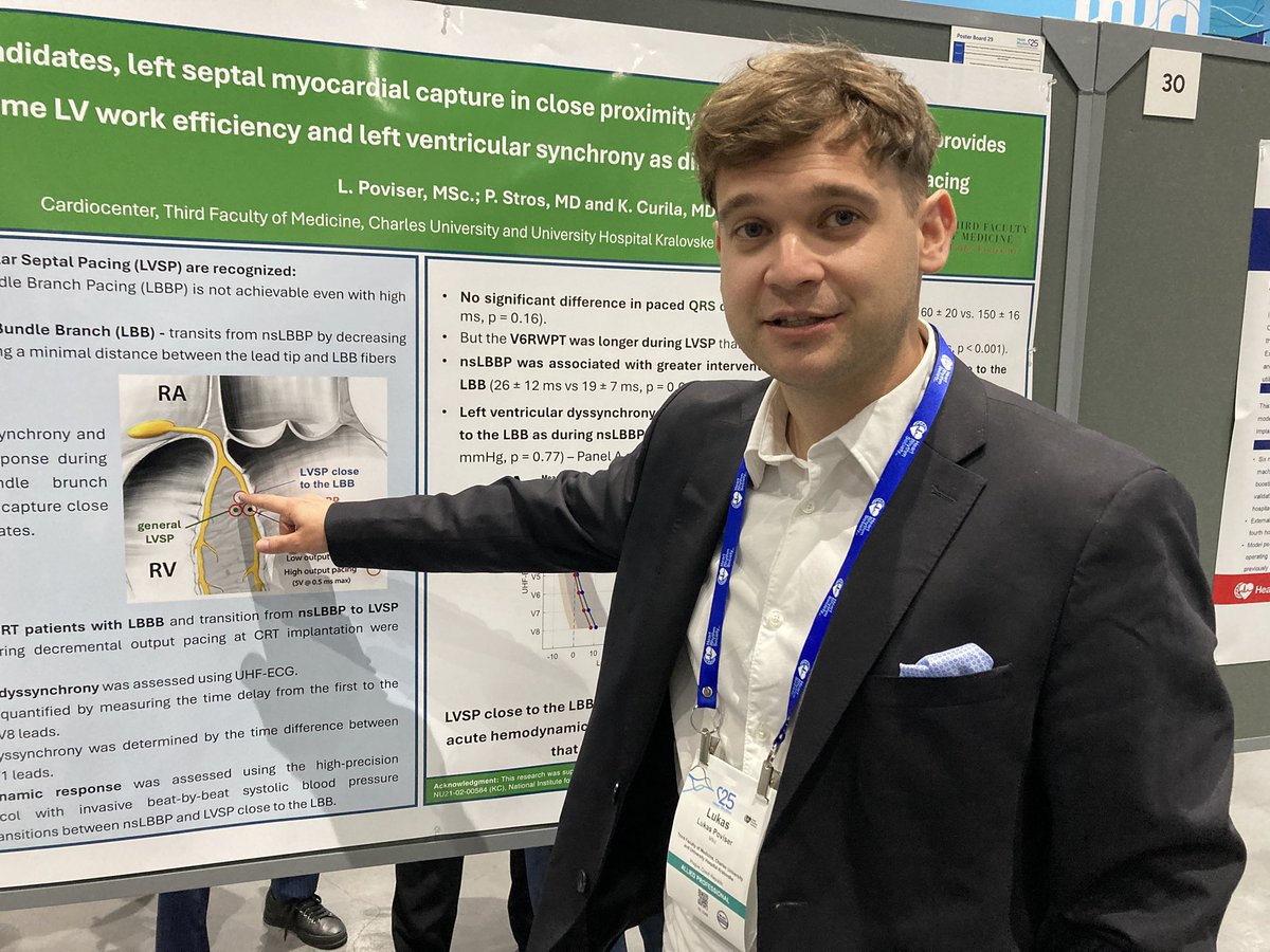 Filip Plesinger (@filipplesinger) on Twitter photo Today I saw nice work by <a href="/LukasPoviser/">Lukáš Povišer</a> at #HRS2025 showing another usecase of our #UHFECG technology. Congratulations for nice work, Lukas:-) Today I saw nice work by <a href="/LukasPoviser/">Lukáš Povišer</a> at #HRS2025 showing another usecase of our #UHFECG technology. Congratulations for nice work, Lukas:-)