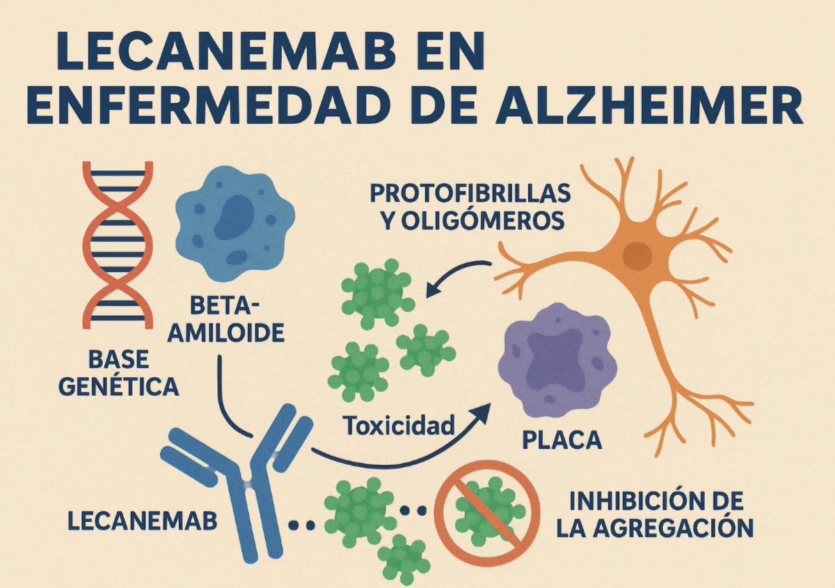 Lecanemab, anticuerpo monoclonal humanizado, Aprobado para tratar el Alzheimer temprano. Se une a las protofibrillas solubles de beta amiloide, consideradas altamente tóxicas, evitando su agregación y reduciendo el daño neuronal. Su diseño genético minimiza reacciones inmunes