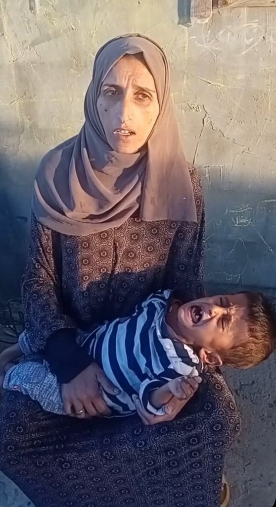 AbujomaaGaza's tweet photo. “Malnourished babies in Gaza don’t have energy to cry, UNICEF says! https://t.co/tYiZTC1HTC