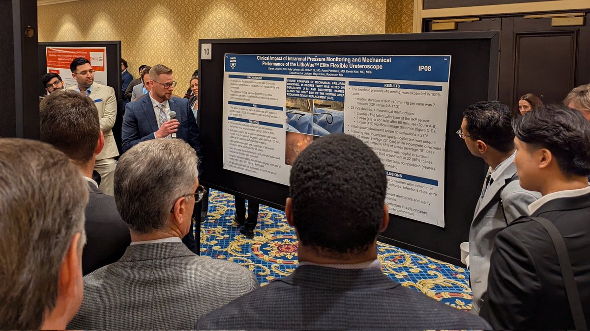 Kevin Koo (@kvnkoo) on Twitter photo In a real world fURS series with intrarenal pressure sensing, 100% of cases exceeded 40 mm Hg threshold, for a median duration of 7 min, but without ⬆️ infectious complications. Raises❔about whether threshold is clinically significant. Provocative work by <a href="/GarrettUngerer/">Garrett Ungerer</a> #AUA25 In a real world fURS series with intrarenal pressure sensing, 100% of cases exceeded 40 mm Hg threshold, for a median duration of 7 min, but without ⬆️ infectious complications. Raises❔about whether threshold is clinically significant. Provocative work by <a href="/GarrettUngerer/">Garrett Ungerer</a> #AUA25