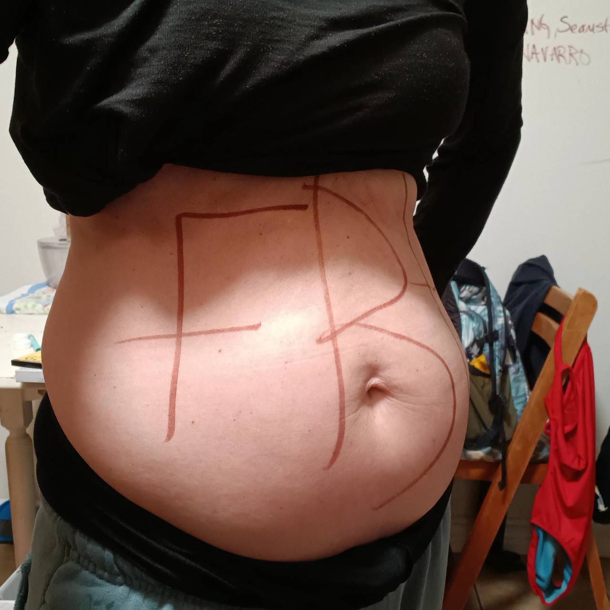 Carakai29's tweet image. #nodueprocess 
#FBI 🇺🇲 #POW YEAR 7 DAY REPORTING CONTINUED  FBI – Federal Bureau of Investigation #Sextrafficking. 
#Evidence attached shows @FBILosAngeles #surgicalrape and #surgicalneutering via #remotesurgery.
👩‍🏫STOP DETAINING #Civilians for #sexslavery
#WomenBeware
#FISA702