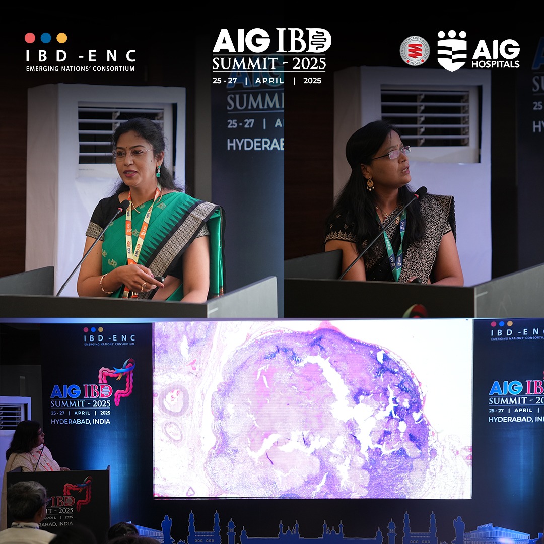 ibd_enc's tweet image. Fantastic start to Day 3 at #AIGIBDSummit2025! Great breakfast sessions on early IUS, personalized nutrition, fast interventions & better pathology communication. Thanks to all who made it engaging! #IBD #Gastroenterology #Hyderabad #MedicalConference