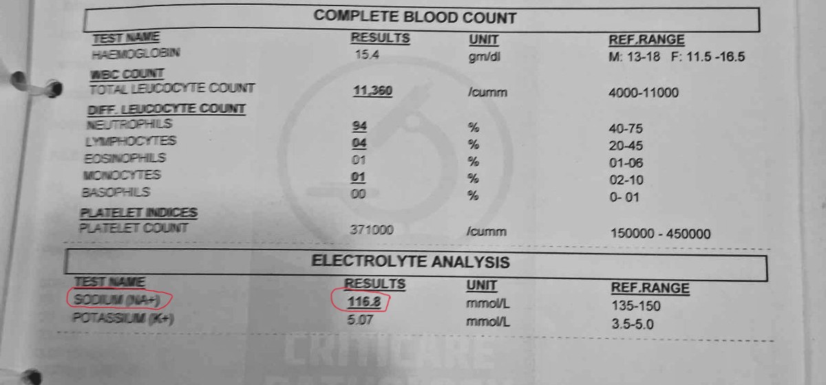 Dr Sudhir Kumar MD DM tweet media