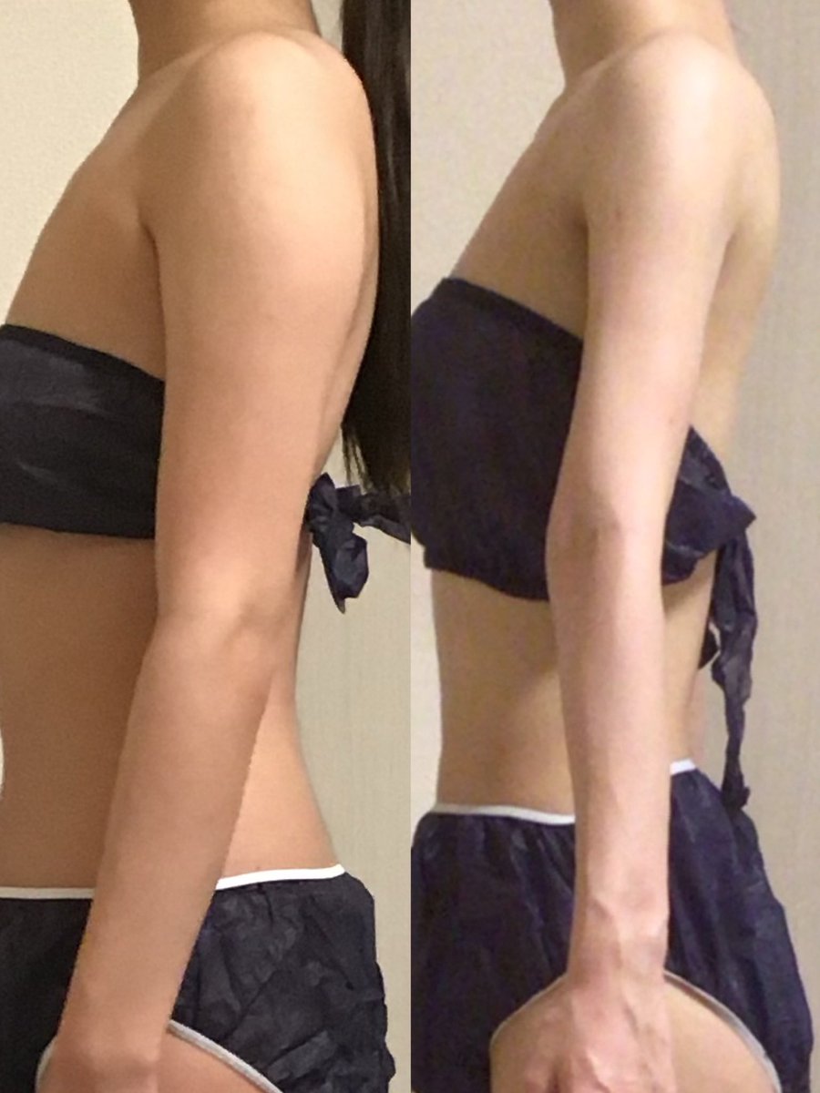 MAYU_0608my's tweet photo. 早い人だとたった5日で圧倒的な効果がでる二の腕痩せストレッチ。
結局これが1番効果ある。二の腕なんて細い方が良いに決まってる https://t.co/mT8yLyVSuu