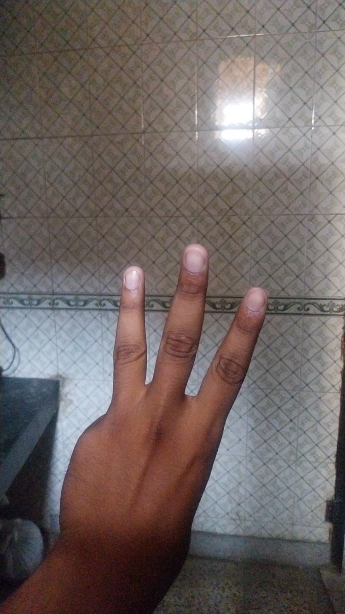 Everywheree is watcher.
#WatchersEverywhere #watcher