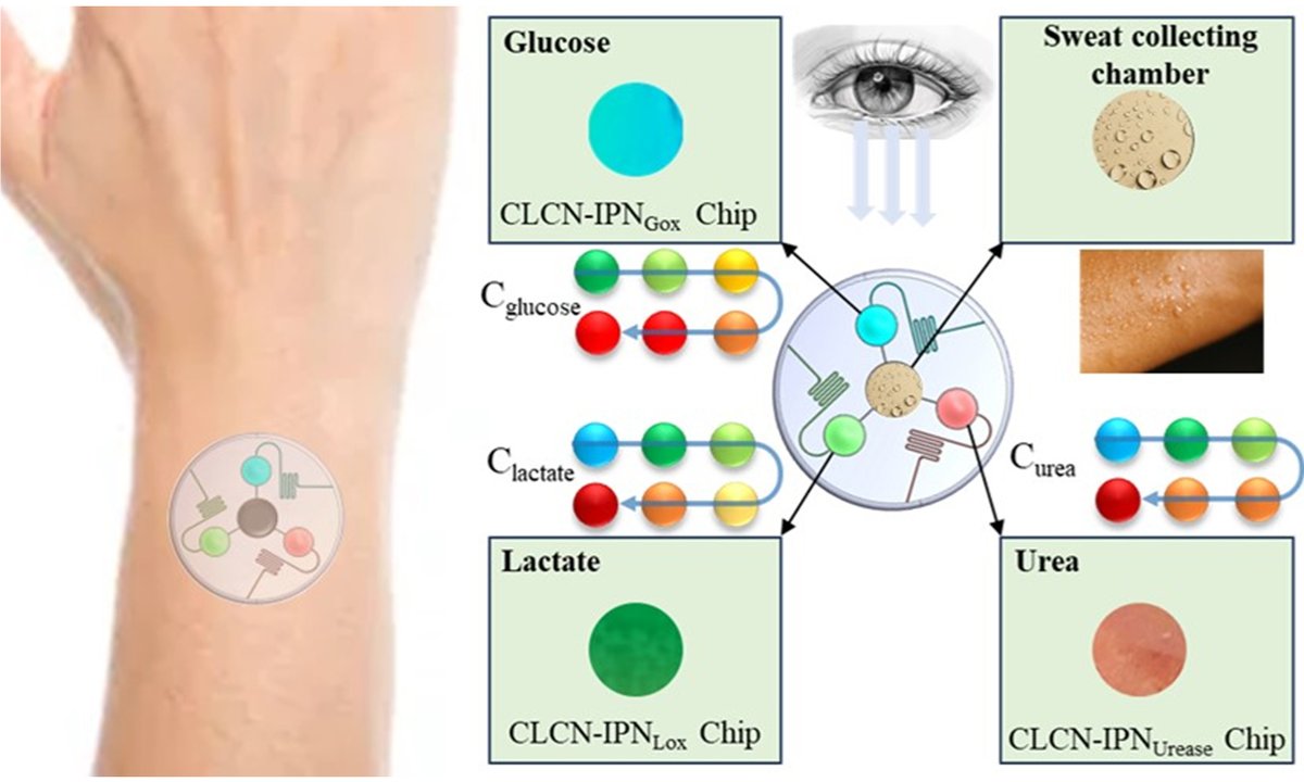OAE_SoftScience's tweet photo. 📢 New Publication Alert!
We are excited to announce the latest article from our Editorial Board Member, Prof. Mohammed Zourob.
Title: Smart Wearable Photonic Array Biosensor for Human Sweat Analysis
#SmartWearables #PhotonicBiosensors #SweatAnalysis
🔗 https://t.co/ospjXEFea7 https://t.co/KLUdHjjZgs
