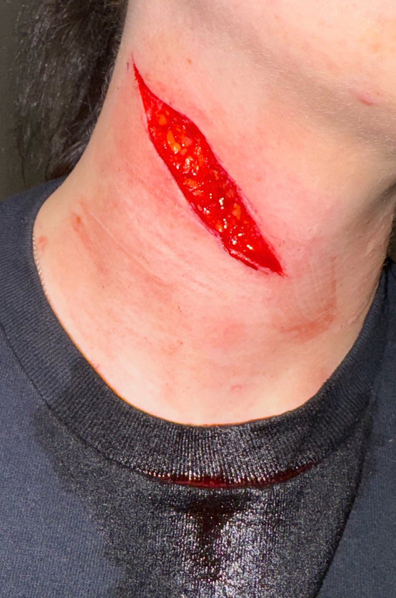 twt_borderline's tweet photo. Just a little cut from the weekend the staff don’t know anything about it… https://t.co/XHGUyttNkl