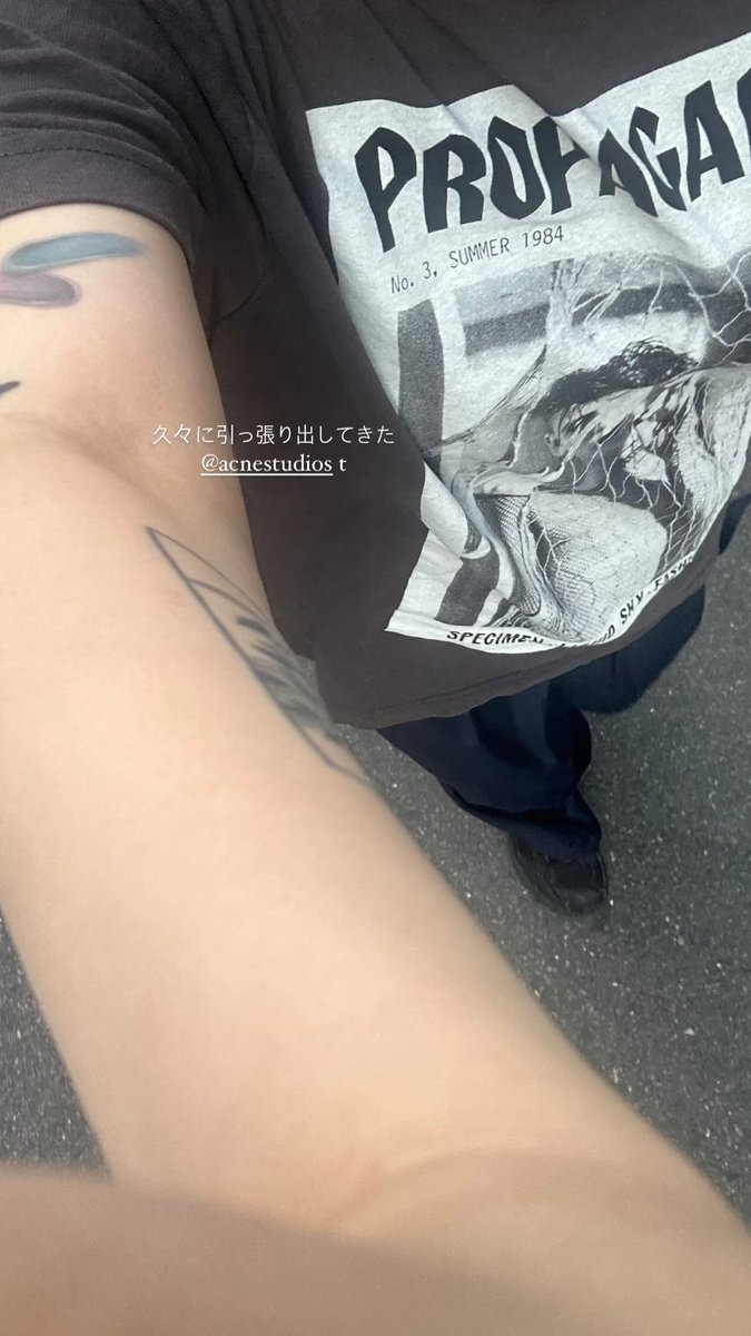 o51_11's tweet photo. アクネ引っ張りだしてきた https://t.co/de1p7MFuQr