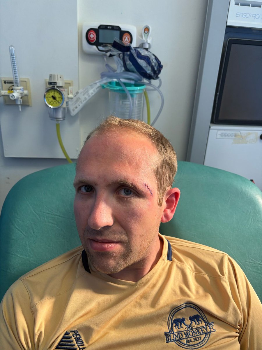 Massive thank-you to <a href="/SheffieldHosp/">Sheffield Hospitals</a> staff today who stitched me up after a head injury during a football game today. 

Our <a href="/NHSuk/">NHS</a> is always there for us; ready to spring into action, whatever life throws at us (or you throw yourselves towards…).

Gory photo alert….