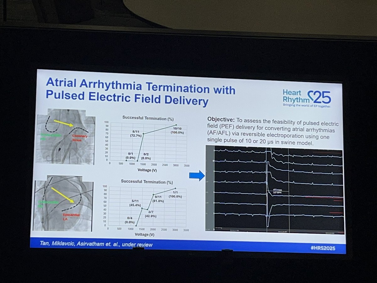 Wrapped up #HRS2025 on a high note co-chairing a PFA basics session with Dr Asirvatham 
Key takeaways:
•Rev electroporation = spectrum → gene therapy?
•PFA collateral injury mild, wide safety margin
•Larger cells = more vulnerable
•if you can pace post PFA- bad news