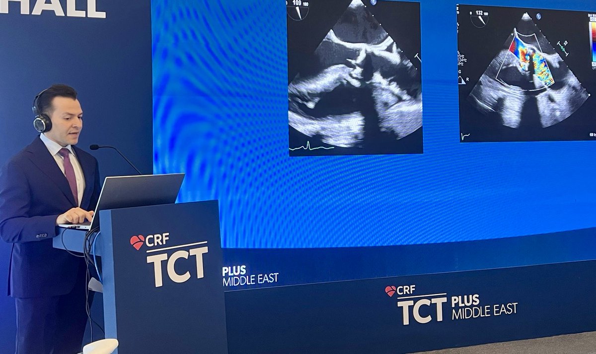 Grateful to have participated in <a href="/TCT_ME_/">TCTME+</a> 2025 in Riyadh, Saudi Arabia. The event had incredible energy, and the hospitality of the organizing team was truly exceptional.
I was deeply impressed by the rapid advancements in Structural and Interventional Cardiology in Saudi Arabia.