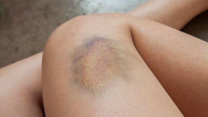 Image in tweet by Analyze & Optimize