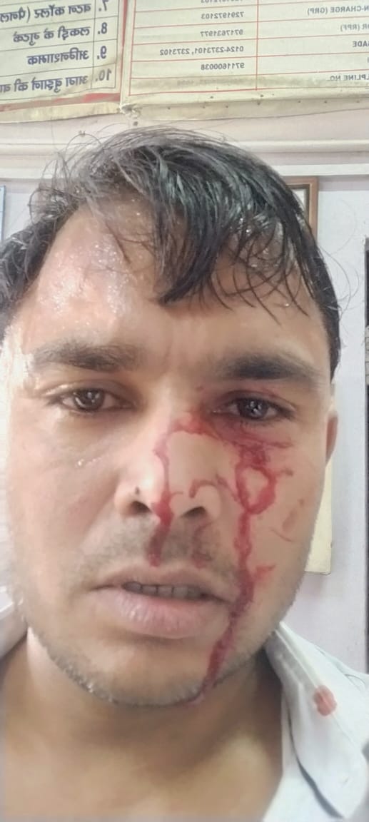 ShriMeena29's tweet photo. TNC beat up and injured a loco pilot at the Garhi Harsaru headquarters of Northern Railway
@drm_dli  @pccm_nr @RailwayNorthern @RailMinIndia @RailwaySeva @RailMinIndia https://t.co/t1BpgEELID