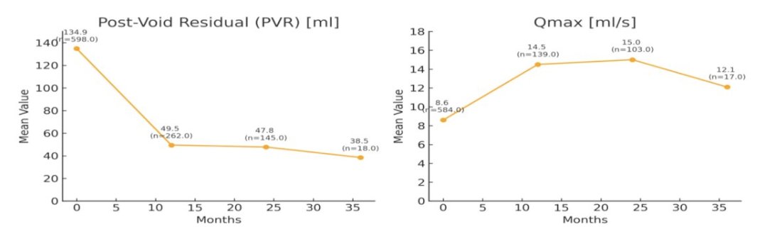 UroToday.com (@urotoday) on Twitter photo Long-term outcomes of Rezūm therapy in a large, multi-centre, international cohort: 3-year analysis of symptom relief and quality of life in patients with benign prostatic enlargement. Presentation by <a href="/DrDeanElterman/">Dean Elterman</a> <a href="/UofT/">University of Toronto</a>. #AUA25 written coverage by <a href="/tiffvnyhuang/">Tiffany Huang</a> <a href="/UCI_Urology/">UCI Urology</a> > Long-term outcomes of Rezūm therapy in a large, multi-centre, international cohort: 3-year analysis of symptom relief and quality of life in patients with benign prostatic enlargement. Presentation by <a href="/DrDeanElterman/">Dean Elterman</a> <a href="/UofT/">University of Toronto</a>. #AUA25 written coverage by <a href="/tiffvnyhuang/">Tiffany Huang</a> <a href="/UCI_Urology/">UCI Urology</a> >
