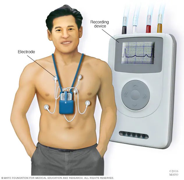 What is a Holter monitor?

A Holter monitor is a portable, battery-operated medical device designed to continuously record the electrical activity of the heart over an extended period, typically 24 to 48 hours, though some may be worn for up to two weeks. 

It is essentially a