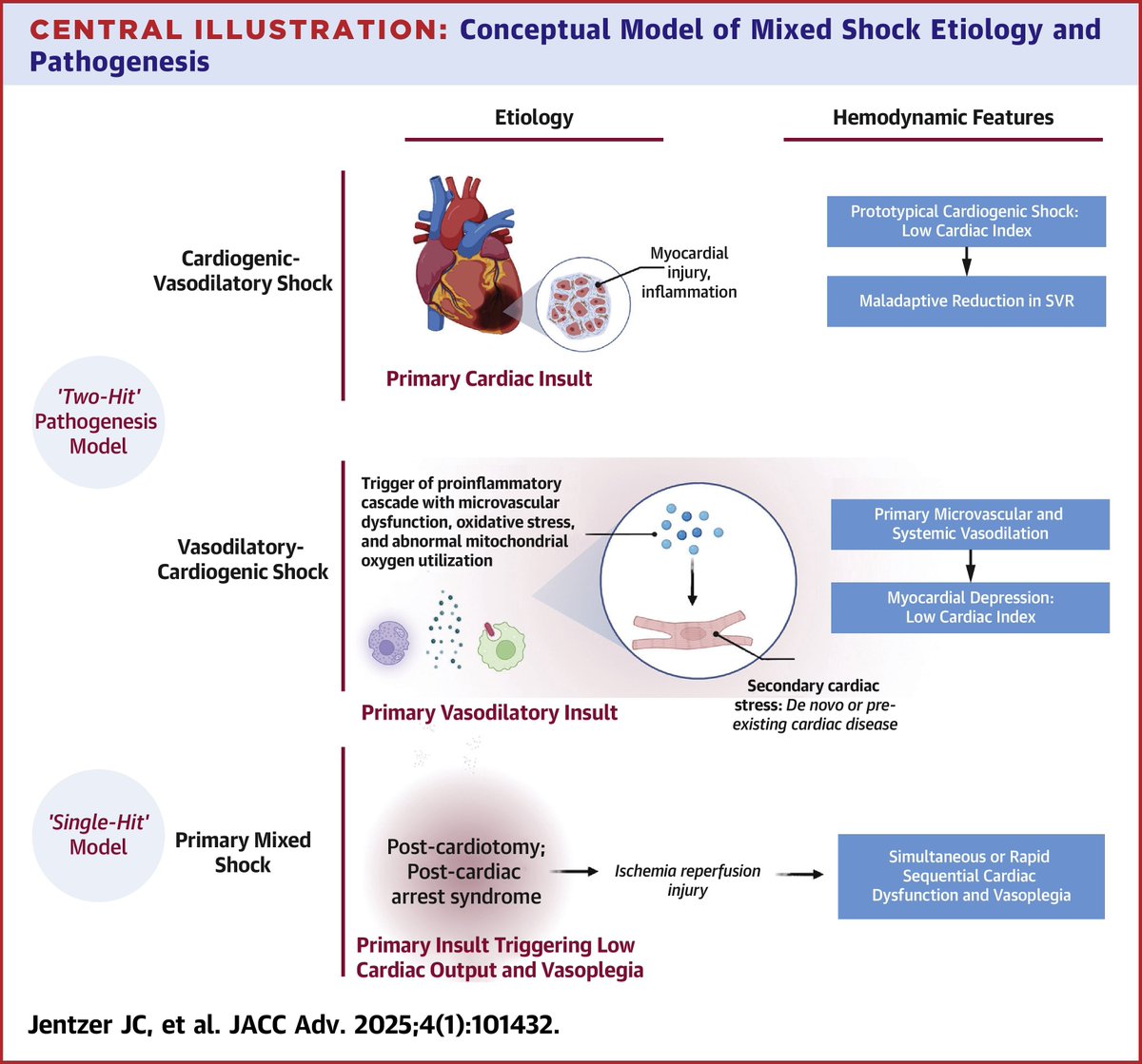 JACC Journals (@jaccjournals) on Twitter photo 🚨 Not all shock is black or white. Mixed cardiogenic + vasodilatory shock is a different beast. Complex, lethal — and underrecognized.
Master this gray zone: jacc.org/doi/10.1016/j.…
<a href="/SarasVallabhMD/">Saraschandra Vallabhajosyula, MD MSc</a> <a href="/ddbergMD/">David Berg</a> <a href="/ShashankSinhaMD/">Shashank Sinha, MD, MSc, FACC, FAHA, FHFSA</a> #CriticalCare #CardiogenicShock #JACCAdvances 🚨 Not all shock is black or white. Mixed cardiogenic + vasodilatory shock is a different beast. Complex, lethal — and underrecognized.
Master this gray zone: jacc.org/doi/10.1016/j.…
<a href="/SarasVallabhMD/">Saraschandra Vallabhajosyula, MD MSc</a> <a href="/ddbergMD/">David Berg</a> <a href="/ShashankSinhaMD/">Shashank Sinha, MD, MSc, FACC, FAHA, FHFSA</a> #CriticalCare #CardiogenicShock #JACCAdvances