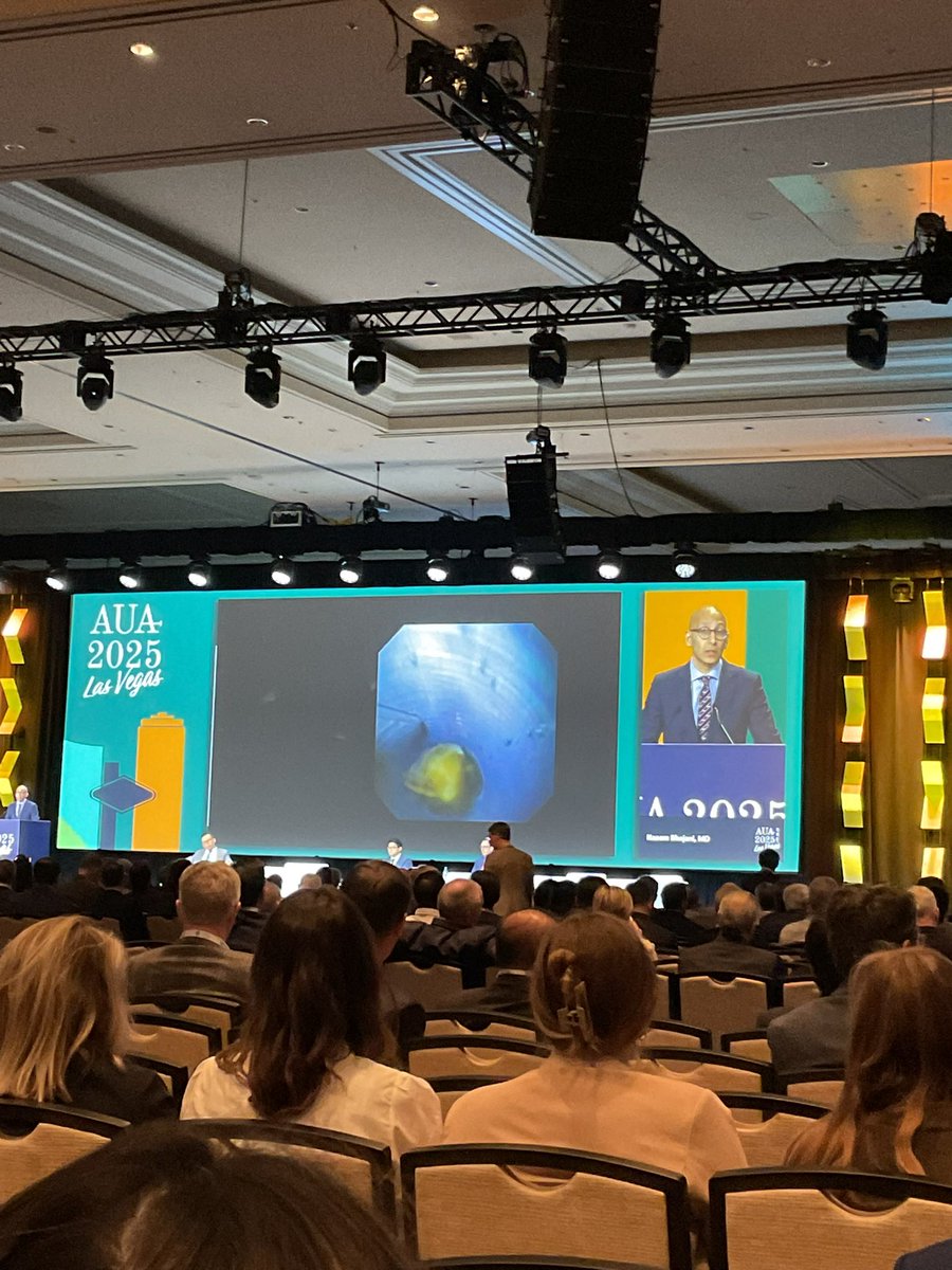 Dr. Rodrigo Donalisio (@rdonalisiomd) on Twitter photo As always, great talk by <a href="/naeembhojani7/">Naeembhojani7</a> showing practical tips on suction ureteral access sheath and intrarenal pressure during flexible ureteroscopy. THE FUTURE IS NOW #aua2005 #urosome <a href="/AmerUrological/">Amer. Urol. Assn.</a> <a href="/CanUrolAssoc/">Canadian Urological Association</a> <a href="/bsc_urology/">Boston Scientific Urology</a> <a href="/OlympusUrology/">Olympus Urology Europe</a> As always, great talk by <a href="/naeembhojani7/">Naeembhojani7</a> showing practical tips on suction ureteral access sheath and intrarenal pressure during flexible ureteroscopy. THE FUTURE IS NOW #aua2005 #urosome <a href="/AmerUrological/">Amer. Urol. Assn.</a> <a href="/CanUrolAssoc/">Canadian Urological Association</a> <a href="/bsc_urology/">Boston Scientific Urology</a> <a href="/OlympusUrology/">Olympus Urology Europe</a>