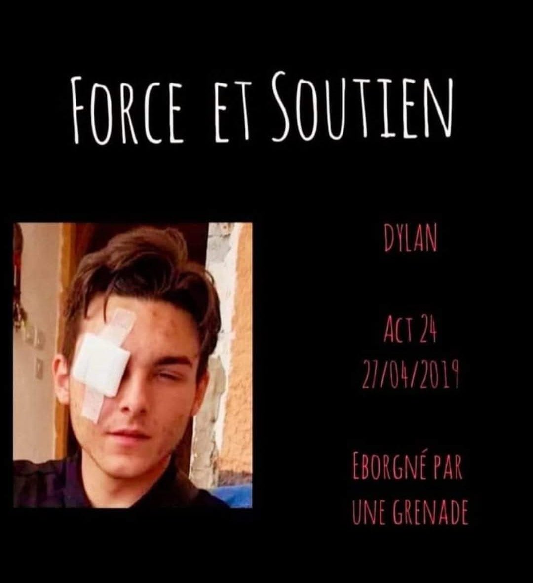 6 ans aujourd'hui que dylan fut eborgné 
Aucun procès , aucune justice 
On lache rien