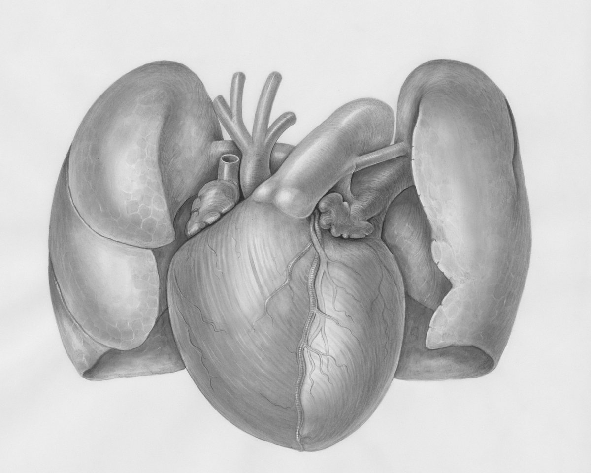 JWatch's tweet image. Does thoracentesis benefit patients with acute heart failure and pleural effusions? jwat.ch/3Gsspwx

#HeartFailure #thoracentesis