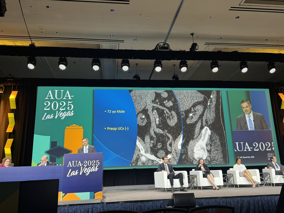 URMC Department of Urology (@urmcurology) on Twitter photo So thrilled to attended Dr. Scott Quarrier’s discussion today during the Semi-Live Procedures: Endourology, #BPH plenary! #URMCUrology #AUA25 <a href="/AmerUrological/">Amer. Urol. Assn.</a> <a href="/squarrier/">Scott Quarrier MD MPH</a> So thrilled to attended Dr. Scott Quarrier’s discussion today during the Semi-Live Procedures: Endourology, #BPH plenary! #URMCUrology #AUA25 <a href="/AmerUrological/">Amer. Urol. Assn.</a> <a href="/squarrier/">Scott Quarrier MD MPH</a>