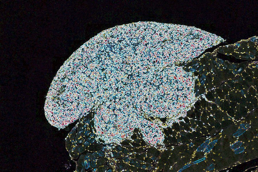 kochinstitute's tweet photo. Visit @yiwenkong1 @LabYaffe at her poster session tomorrow 4/28 at 9am-12pm CT and learn more about how high-grade serous ovarian cancer cells become resistant to platinum-based agents and anti-microtubule drugs—the current clinical standard of care.

https://t.co/gYQvq6ai6h https://t.co/rtw6hE1Z8q