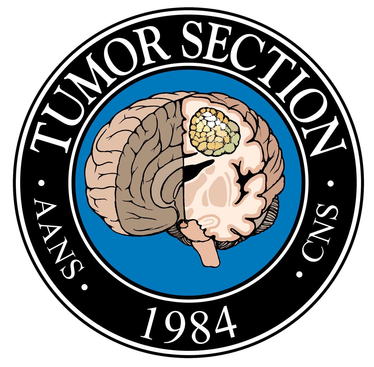 Johns Hopkins Neuro-Oncology Surgical Outcomes Lab (@neurooncsurgery) on Twitter photo Congratulations <a href="/AKarimAhmed4/">A. Karim Ahmed, M.D.</a> for being awarded the <a href="/NSTumorSection/">NS Tumor Section</a> Emerging Technologies and Traveling Fellowship for visiting <a href="/PittNeurosurg/">Pitt Neurosurgery</a>!
And congrats <a href="/JeffreyNadel/">Jeffrey Nadel, MD, MS</a>, we looking forward to working with you on using big data to optimize #cancer care delivery <a href="/HopkinsNsurg/">Johns Hopkins Neurosurgery</a>! Congratulations <a href="/AKarimAhmed4/">A. Karim Ahmed, M.D.</a> for being awarded the <a href="/NSTumorSection/">NS Tumor Section</a> Emerging Technologies and Traveling Fellowship for visiting <a href="/PittNeurosurg/">Pitt Neurosurgery</a>!
And congrats <a href="/JeffreyNadel/">Jeffrey Nadel, MD, MS</a>, we looking forward to working with you on using big data to optimize #cancer care delivery <a href="/HopkinsNsurg/">Johns Hopkins Neurosurgery</a>!