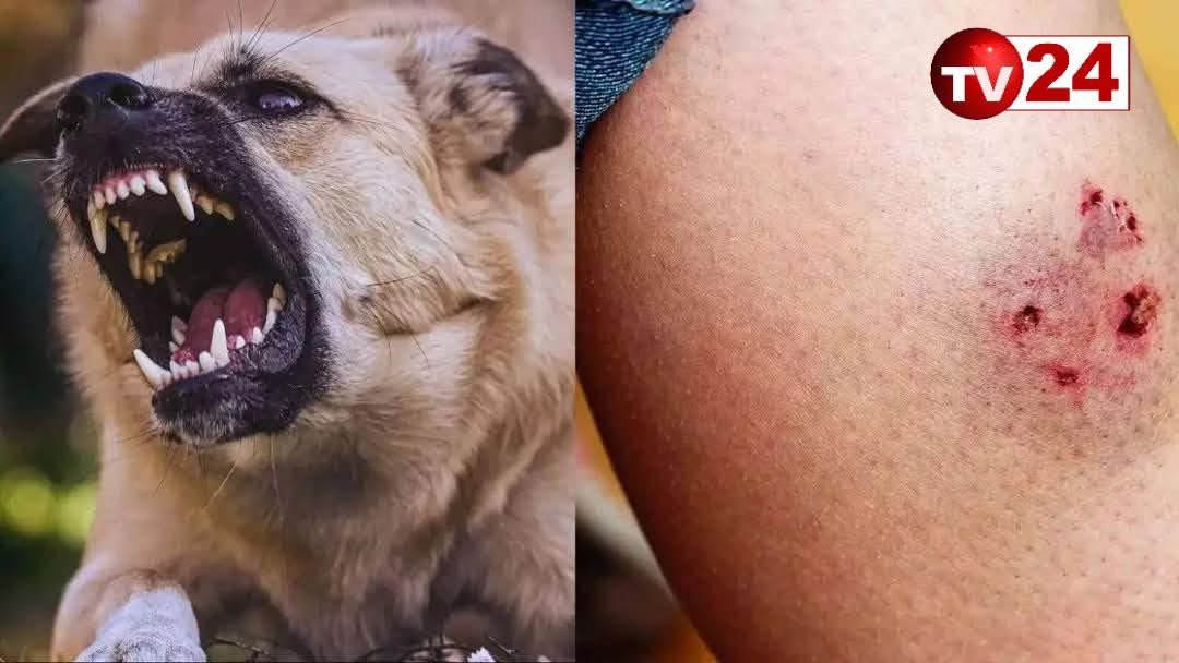 ‼️‼️‼️Нохой нь хүн хазвал эзнийг нь 5.4 саяар торгож, нийтэд тустай ажил хийлгэнэ...