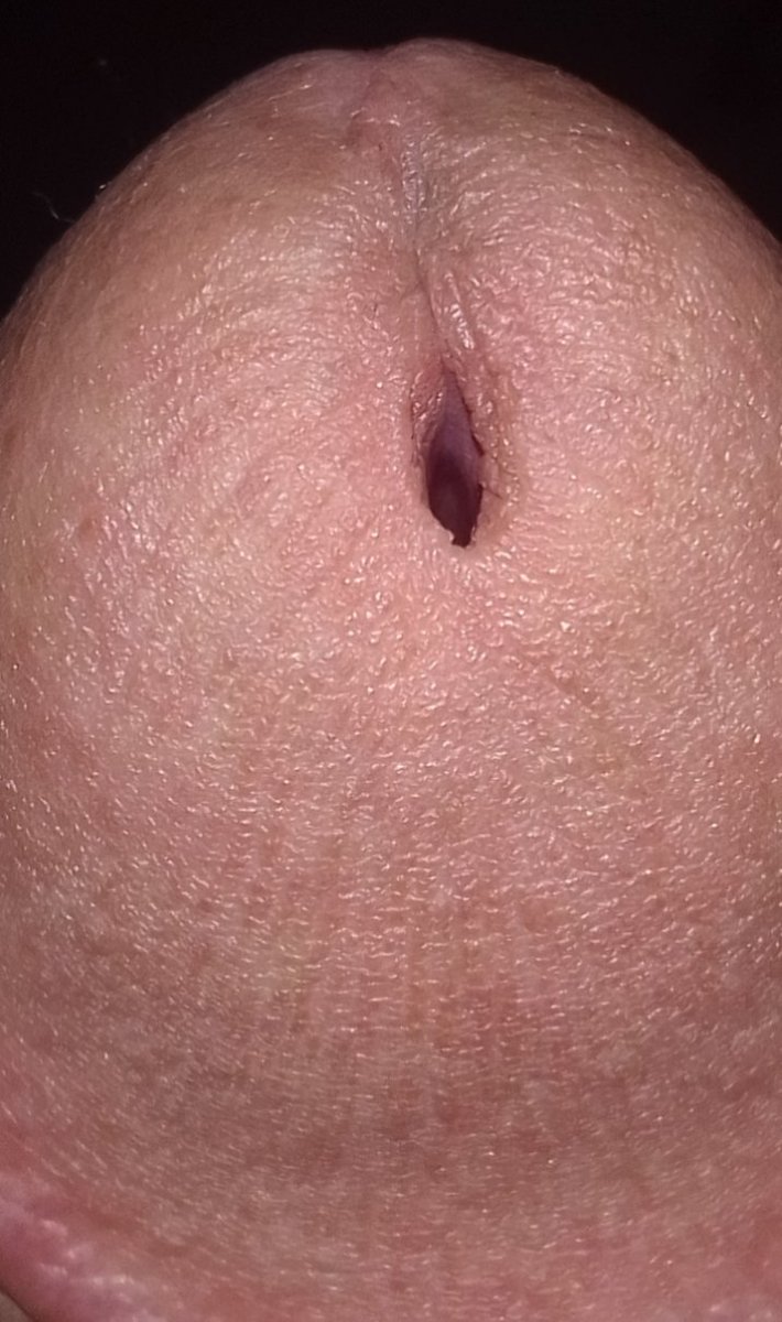 Hoy peleando me partieron la cabeza jajajajajajjaa. Ya te suscribistes a mi telegram que esperas. No saben lo q se pierden jajajajaja