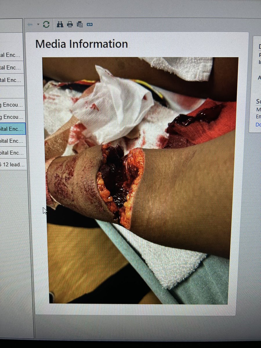 PRINCEYODAYASQ's tweet photo. 3 Hospitals, Tons of blood lost, 1 Life Light, &amp; 1 Emergency operation later…Thanking God for my life. In a moment like this, all I can do is really thank God. Thank you to my family &amp; my brothers for checking on me. Just know, I ain’t going nowhere, #MentalHealthMatters https://t.co/bO6dNax96B