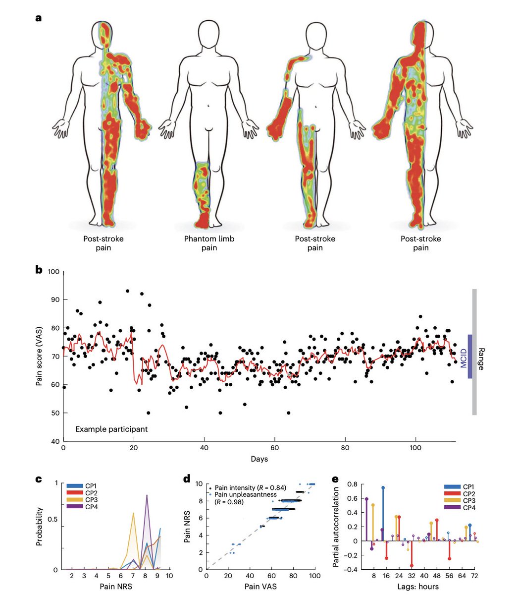 Danny Huang, MD (@yuhaohuangmd) on Twitter photo Human suffering can be decoded from brain activity. Fascinating <a href="/NatNeuro/">Dr Laurie K Mischley</a> study showed that chronic pain severity can be accurately inferred from the prefrontal cortex, thus enabling objective pain tracking and close-loop stimulation approaches for chronic pain. Human suffering can be decoded from brain activity. Fascinating <a href="/NatNeuro/">Dr Laurie K Mischley</a> study showed that chronic pain severity can be accurately inferred from the prefrontal cortex, thus enabling objective pain tracking and close-loop stimulation approaches for chronic pain.