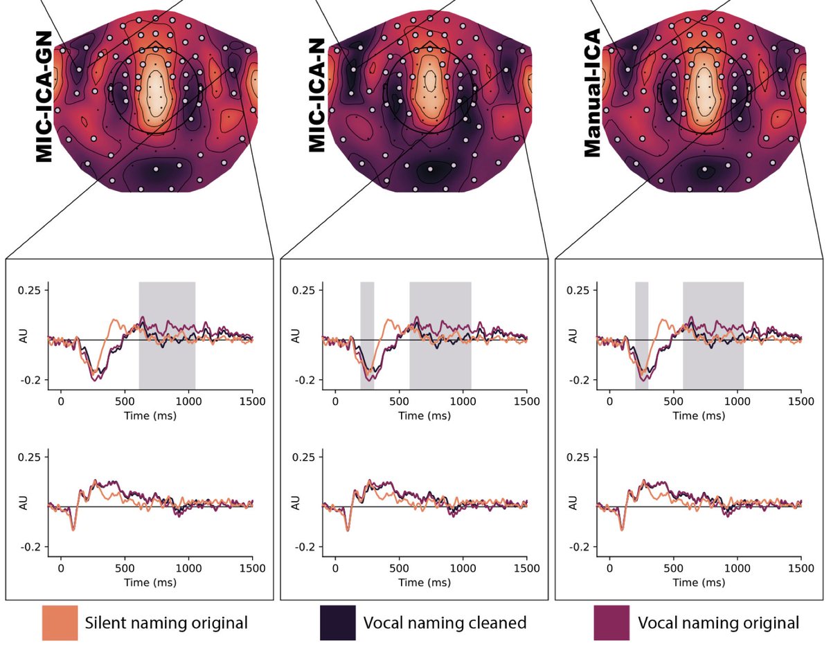 New paper in Imaging Neuroscience by Sara Tuomaala, Mia Liljeström, et al:

Automated speech artefact removal from MEG data utilizing facial gestures and mutual information

doi.org/10.1162/imag_a…