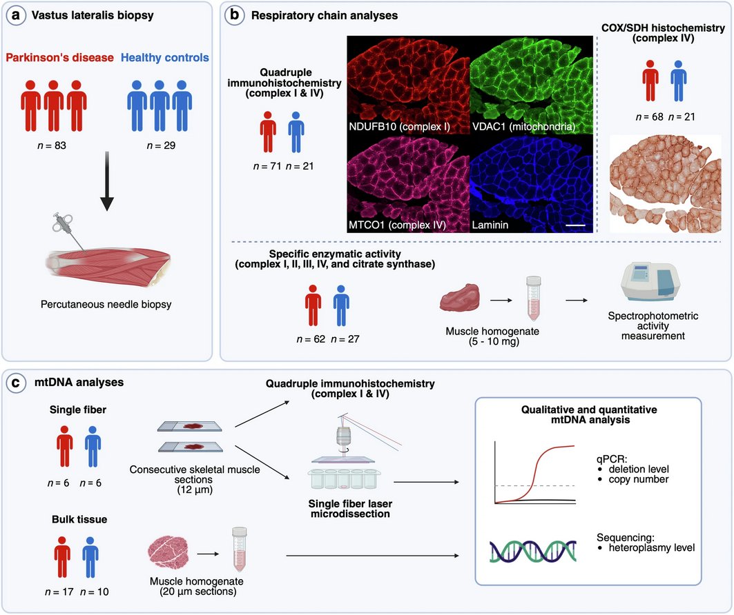 The Science of Parkinson's (@scienceofpd) on Twitter photo New research from <a href="/chtzoulis/">Charalampos Tzoulis</a> & <a href="/UiB/">Universitetet i Bergen</a> colleagues reports the existence of a #Parkinsons subpopulation characterized by mitochondrial complex I pathology in skeletal muscle; Useful stratification for selecting participants for clinical trials?
nature.com/articles/s4385… New research from <a href="/chtzoulis/">Charalampos Tzoulis</a> & <a href="/UiB/">Universitetet i Bergen</a> colleagues reports the existence of a #Parkinsons subpopulation characterized by mitochondrial complex I pathology in skeletal muscle; Useful stratification for selecting participants for clinical trials?
nature.com/articles/s4385…