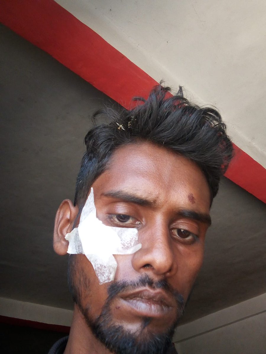 अंबेडकर नगर के कटका पुलिस स्टेशन के एस,एच,ओ विवेक वर्मा जी है जिनको कानून को रौंदने का शौक है एक हरौली गोबिंदसहब के सुदेश कुमार जो कि बेहद गरीब है उसको दबंगों द्वारा मारा जाता है सर हाथ एवं मुंह प गंभीर छोटे अति है लेकिन उसका रिपोर नहीं लिखा जाता, पुलिस पैसा लेके मामला दबा दिया।