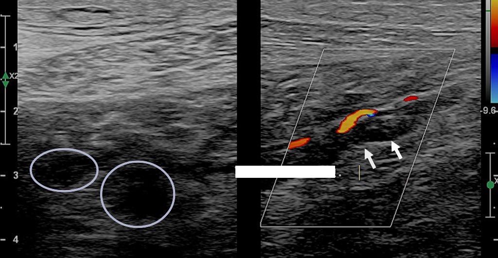 Marcos A. P. Borges, MD 🇧🇷 tweet media