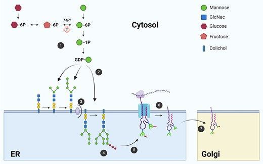 Clinical Chemistry (@clin_chem_adlm) on Twitter photo #Genetic Metabolic Series: "Mannose Phosphate Isomerase Deficiency-Congenital Disorder of Glycosylation Type 1b: Familial Case of #Thrombophilia and Liver Disorder"
by Franklin Ducatez & others
<a href="/CHURouen/">CHU de Rouen</a>
<a href="/IvanaDabaj/">Ivana Dabaj</a>
👉 buff.ly/GNv0r2E
#PathTwitter #LabMedX #MedTwitter #Genetic Metabolic Series: "Mannose Phosphate Isomerase Deficiency-Congenital Disorder of Glycosylation Type 1b: Familial Case of #Thrombophilia and Liver Disorder"
by Franklin Ducatez & others
<a href="/CHURouen/">CHU de Rouen</a>
<a href="/IvanaDabaj/">Ivana Dabaj</a>
👉 buff.ly/GNv0r2E
#PathTwitter #LabMedX #MedTwitter
