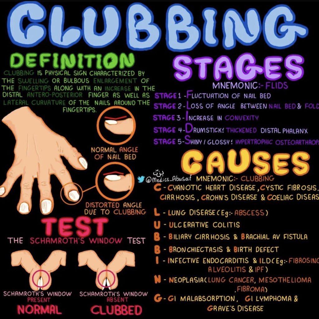 Clubbing 💥