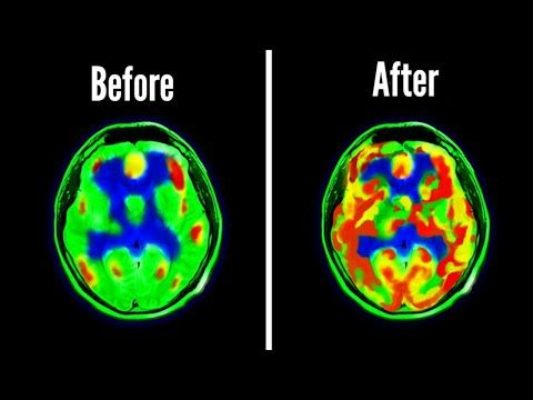 iamjacobeagles's tweet photo. The real reason you're exhausted, distracted, and unmotivated?

Your dopamine system is fried.

Here’s a step-by-step fix to reboot your brain — in just 30 days: 🧵 https://t.co/QzGADKkFeY