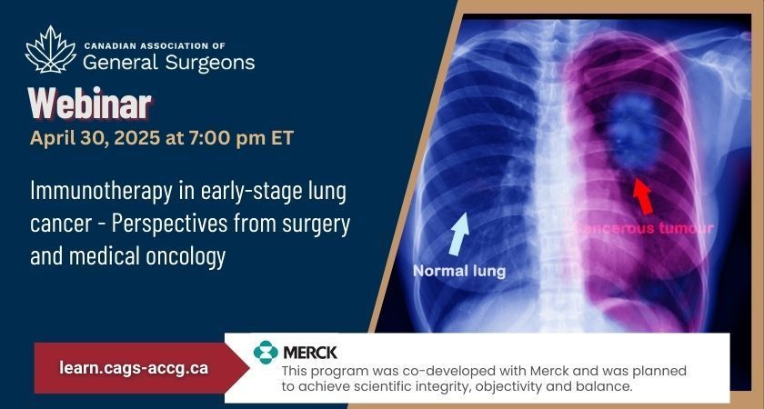CSSO (@_csso) on Twitter photo 💻 Webinar in partnership w/ <a href="/CAGS_ACCG/">Cdn General Surgeons</a> Apr 30 at 7pm ET on immunotherapy in early-stage #LungCancer
Learn the latest advances in treatment, discuss factors affecting patient eligibility, and identify the right timing for administering immunotherapy. 🔗 buff.ly/C599NYp 💻 Webinar in partnership w/ <a href="/CAGS_ACCG/">Cdn General Surgeons</a> Apr 30 at 7pm ET on immunotherapy in early-stage #LungCancer
Learn the latest advances in treatment, discuss factors affecting patient eligibility, and identify the right timing for administering immunotherapy. 🔗 buff.ly/C599NYp