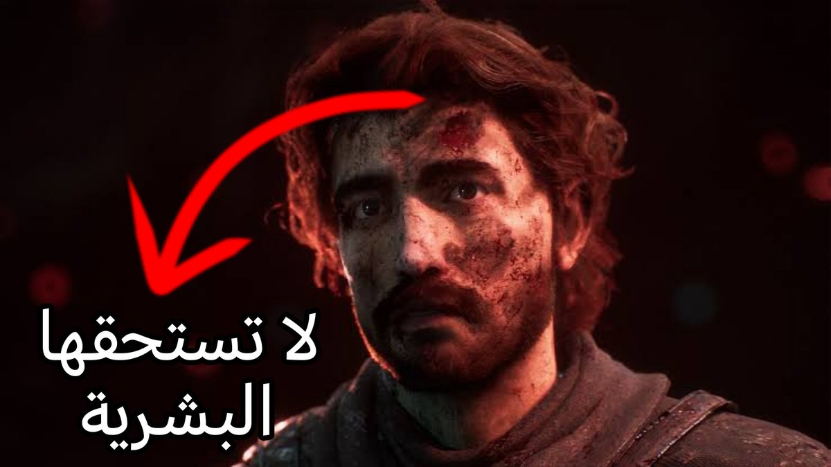 أجمع أعضاء حزب الرأي السديد إجماعًا تامًّا دون فرقة أو اختلاف أو ظن:

- على إعطاء لعبة Expedition 33 تقييم 9.5/10 ، لتكون أعلى لعبة تقييمًا في تاريخ حزب السديد.

- تم سحب نصف درجة بسبب ظهور شعار Unreal Engine عند بدء اللعبة.