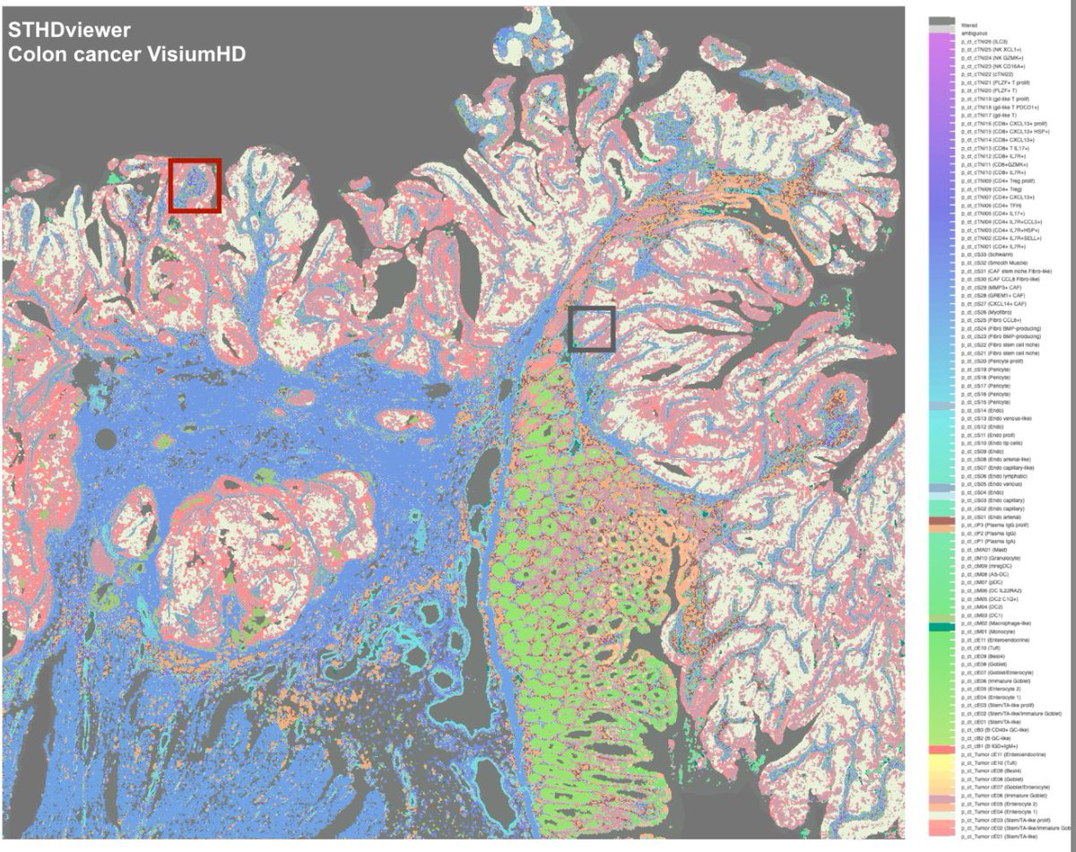 Welcome to visit our lab’s 1st #AACR poster! STHD: ML/AI method for sub-cellular cell typing for spatial transcriptomics (eg. 2um spots in VisiumHD) by integrating scRNA reference. (Section45 Board27) #AACR2025 Recruiting-ML/AI for Omics at Duke!