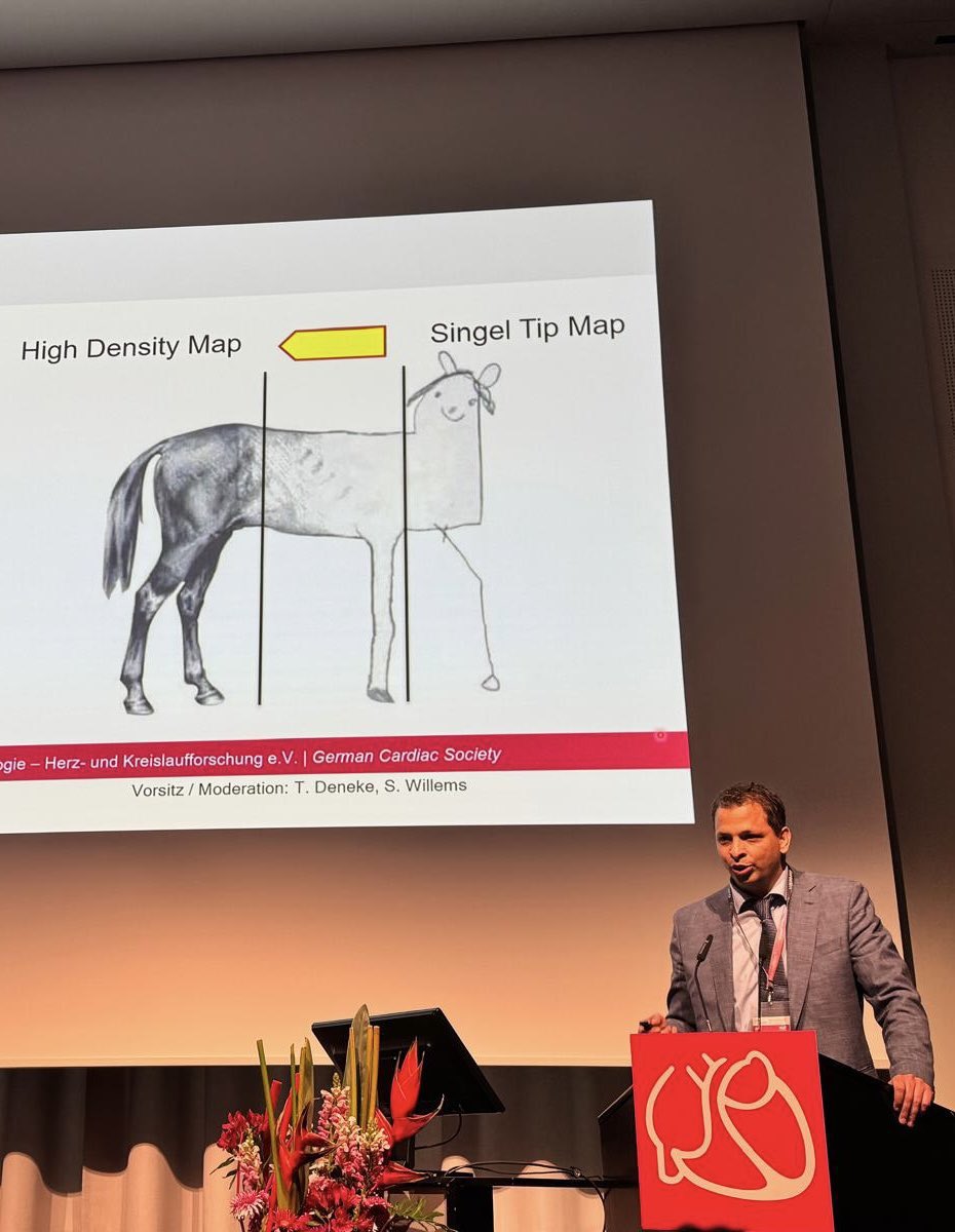 Arab HRS - Heart Rhythm Society (@arabhrs) on Twitter photo 🧵Our own, Dr Mustapha El Hamriti, presenting on single-tip vs. high-density mapping at 👇 <a href="/melhamriti/">El Hamriti Mustapha</a>
The goal is to analyze signals from every myocyte. Seeing more leads to better understand individual mechanisms, which enables personalized ablation strategies — #Epeeps 🧵Our own, Dr Mustapha El Hamriti, presenting on single-tip vs. high-density mapping at 👇 <a href="/melhamriti/">El Hamriti Mustapha</a>
The goal is to analyze signals from every myocyte. Seeing more leads to better understand individual mechanisms, which enables personalized ablation strategies — #Epeeps