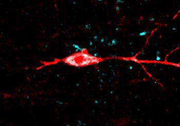 UK Dementia Research Institute (@ukdri) on Twitter photo New research led by <a href="/marcaurelbusche/">Marc Aurel Busche</a> has found that tau specifically disrupts a certain type of electrical activity in the hippocampus in Alzheimer's🧠
The findings unlock a key piece of the puzzle in understanding how toxic tau drives memory problems👏👉buff.ly/yx8Rdk6 New research led by <a href="/marcaurelbusche/">Marc Aurel Busche</a> has found that tau specifically disrupts a certain type of electrical activity in the hippocampus in Alzheimer's🧠
The findings unlock a key piece of the puzzle in understanding how toxic tau drives memory problems👏👉buff.ly/yx8Rdk6