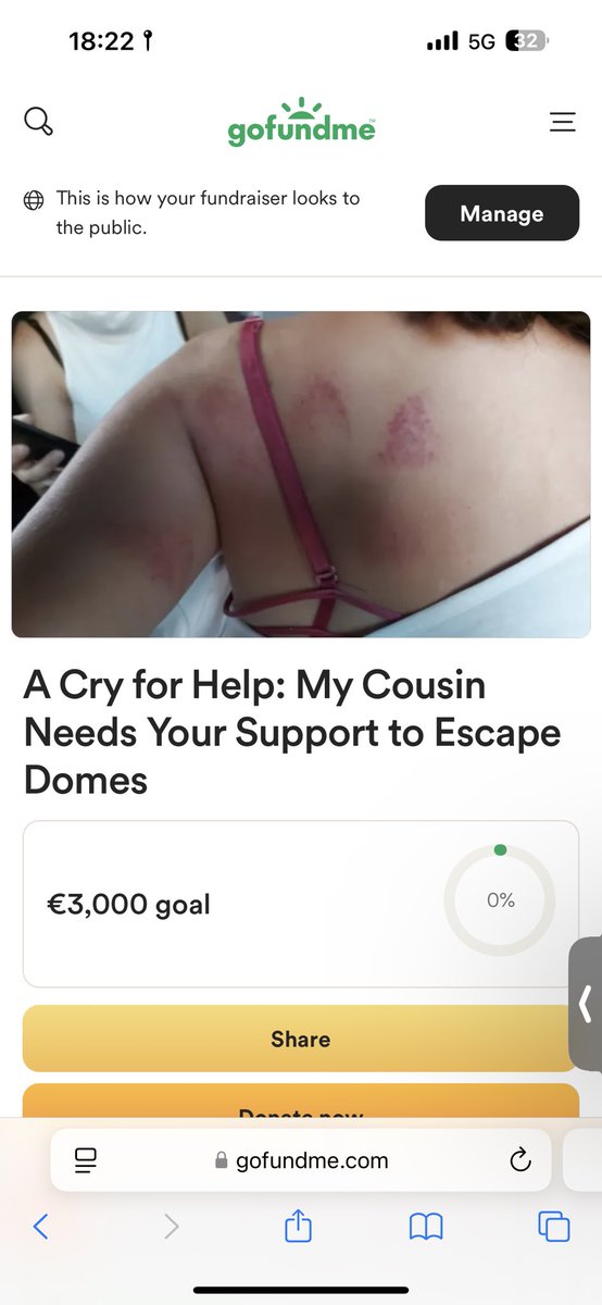 EfeAr494853's tweet photo. I could use your help with my fundraiser on GoFundMe. Please share, support, or donate—every small action counts. https://t.co/DsdEredD3C https://t.co/O7Q1THG7tf