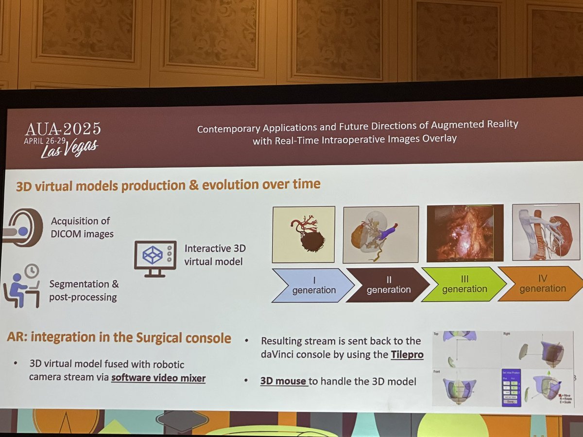 Zeyad Schwen MD (@zschwen) on Twitter photo Great presentation on Augmented Reality in Urology by <a href="/danieleamparore/">Daniele Amparore</a> at the EUS with an All-star cast of moderators <a href="/drjkaouk/">Dr. J. Kaouk</a> <a href="/ricautor/">Riccardo Autorino MD PhD FACS</a> <a href="/Cacciamani_MD/">Dr. Giovanni E Cacciamani MD MSc FEBU 🇮🇹🇺🇸🇪🇺</a> Dr. Weaver <a href="/Endo_Society/">Endourological Society</a> #AUA2025 #aua25 <a href="/CleClinicUro/">Cleveland Clinic Urology</a> Great presentation on Augmented Reality in Urology by <a href="/danieleamparore/">Daniele Amparore</a> at the EUS with an All-star cast of moderators <a href="/drjkaouk/">Dr. J. Kaouk</a> <a href="/ricautor/">Riccardo Autorino MD PhD FACS</a> <a href="/Cacciamani_MD/">Dr. Giovanni E Cacciamani MD MSc FEBU 🇮🇹🇺🇸🇪🇺</a> Dr. Weaver <a href="/Endo_Society/">Endourological Society</a> #AUA2025 #aua25 <a href="/CleClinicUro/">Cleveland Clinic Urology</a>