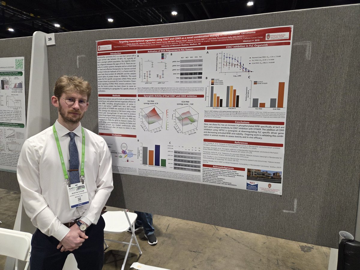 Jeremy Kratz (@jeremykratz) on Twitter photo Austin Stram <a href="/UWCarbone/">UW Health | Carbone Cancer Center</a> showing unique dependency of CDK7/9 against #FLC in engineered DNAJB1-PRKACA fusion model. <a href="/FibroFoundation/">Fibrolamellar Cancer</a> #rarecancer <a href="/em_livercancer/">Fight Liver Cancer</a> Austin Stram <a href="/UWCarbone/">UW Health | Carbone Cancer Center</a> showing unique dependency of CDK7/9 against #FLC in engineered DNAJB1-PRKACA fusion model. <a href="/FibroFoundation/">Fibrolamellar Cancer</a> #rarecancer <a href="/em_livercancer/">Fight Liver Cancer</a>