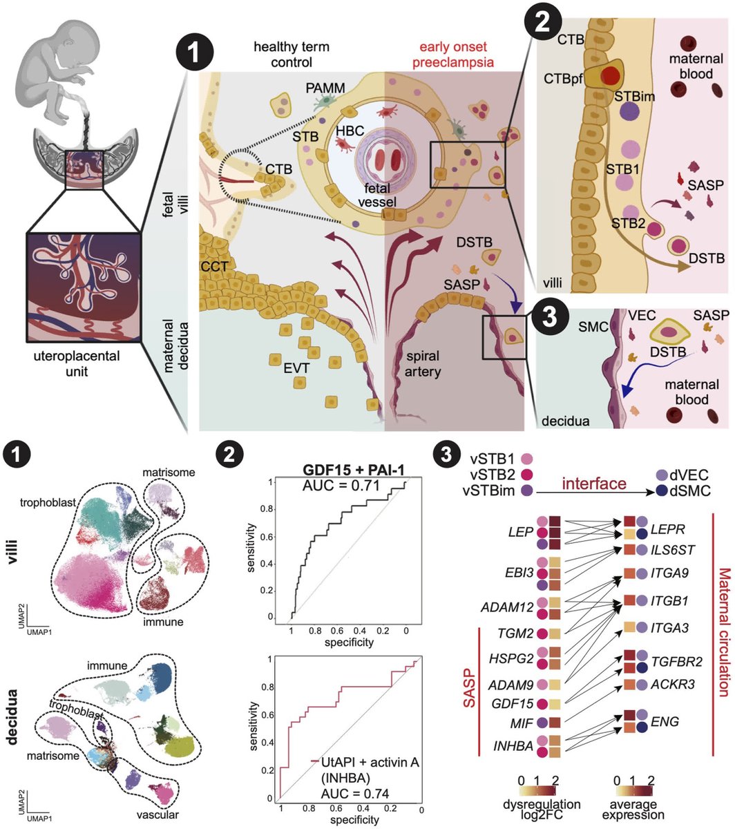 RESEARCH ARTICLE: 
Senescent syncytiotrophoblast secretion during early-onset preeclampsia

ahajrnls.org/4jSZ396