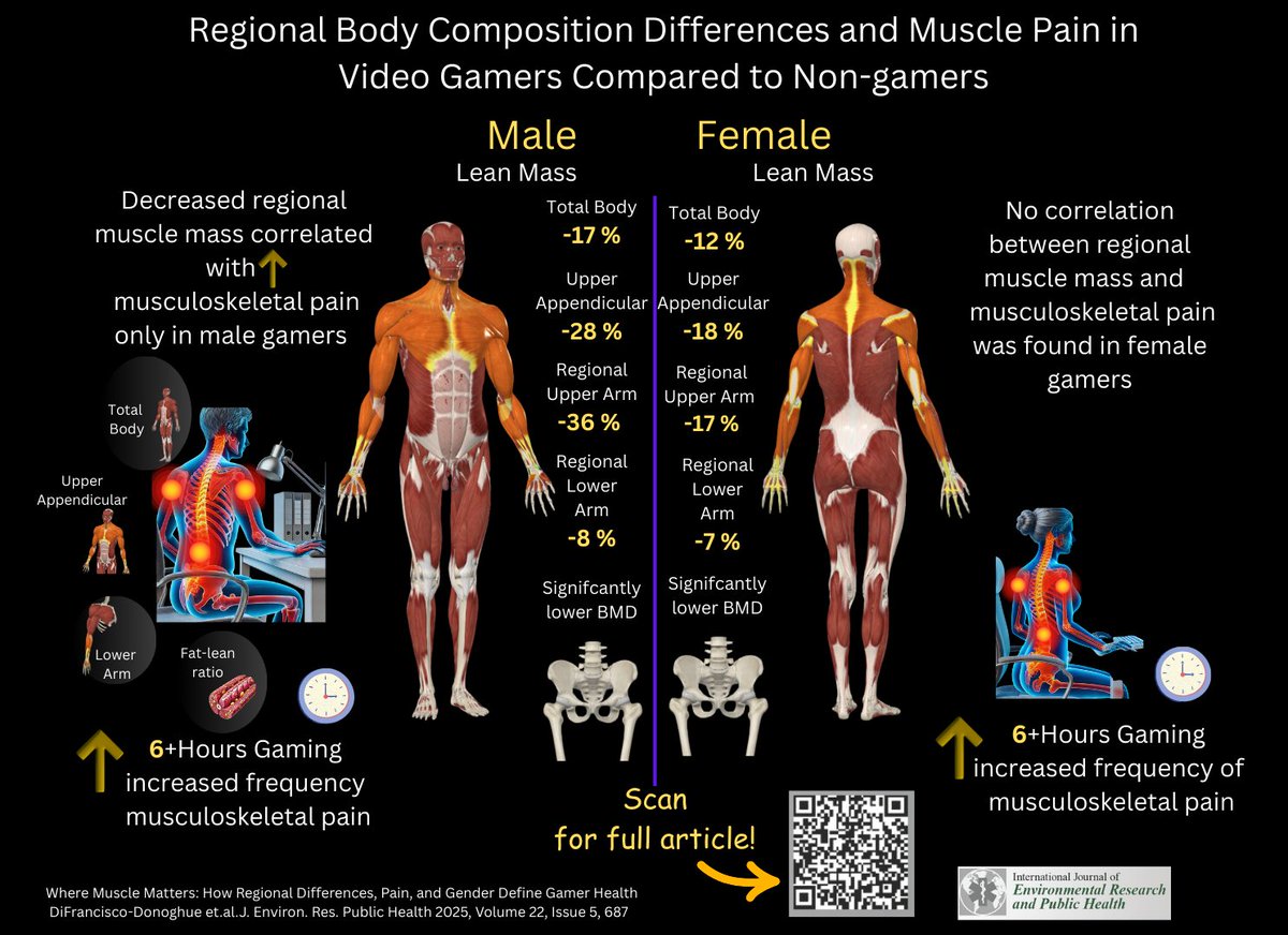 New research: Where Muscle Matters: How Regional Differences, Pain, and Gender Define Gamer Health
mdpi.com/3286086
Gender-specific gaps in regional muscle mass increase pain in collegiate gamers.
BMI fails—lean mass &amp; quality matter
6+ hrs gaming? Pain risk rises
#Esports