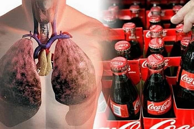 GalacticJack's tweet photo. Ever wondered what exactly is Coca-Cola?
[NAME BRANDS BEWARE]
Coke is the most valuable brand of history and "Coca-Cola" is the second most famous word in the world after "hello". However, the drink itself is absolute poison to human metabolism. Very acidic, the pH is one point higher than battery acid. As a result, it is suitable (and often better) for cleaning surfaces in which we usually use toxic household cleaning agents.
Cheaper and easier to buy in some third world countries than clean water. Coca-Cola uses "PR propaganda" to convince consumers and entire nations that it is an "eco-friendly society", while its activities are actually related to pollution, water scarcity and disease.
Among people who consume soft drinks, for example Coca-Cola, the risk of heart attack and stroke is 48% higher than in those who do not drink such beverages at all, or at least do not drink them every day. According to a study published in the journal Respirology, drinking soft drinks may be associated with lung and respiratory disorders, including asthma and chronic obstructive pulmonary disease (COPD).
The carbonated acid in cola causes calcium loss in bones during a 3-stage process:
📷 Carbonic acid irritates the stomach.
📷 The stomach tries to “cure” the irritation the way it can, i.e. it adds the only acid bond it has: calcium. It comes in the blood to this.
📷 The now low calcium blood from the bones makes up for the missing calcium. Not doing so would severely damage muscle and brain function.
But the story doesn't end here. Another problem with Coke is that it contains phosphorous acid (not the same as carbon dioxide mixed with water). Phosphorous acid affects the body's storage of calcium.
So Coke softens bones in 3 ways (it actually makes them weaker and brittle):
📷 Carbonic acid reduces calcium in bones.
📷 Phosphorous acid reduces calcium in bones.
📷 The drink replaces calcium-containing alternatives, such as milk or water. Milk and water aren’t excellent sources of calcium, but they can still be considered sources.
Oesophagus cancer was very rare two generations ago, and now it's common. The basic mechanism works as follows:
📷 Mechanical damage of cells is a huge risk factor in cancer. This is the reason why asbestos particles cause lung cancer, for example.
📷 All soft drinks cause acid reflux (stomach acid rises higher than the esophagus valve). This is much more emphasized when the body is in a horizontal position (while sleeping), but in most cases, the amount of Coke and other soft drinks consumed means that acid reflux is well beyond the danger point. Whenever we drink a pleasant drink it causes burping and thus the acid enters the esophagus. How much is too much? The research doesn't reveal where the line is, it just shows most of us are way over it.
📷 Stomach acid dissolves tissue - this is its goal. Stomach mucous membrane is not found in the esophagus, so damage to the lower esophagus is much more common in people who consume acidic soft drinks than in non-carbonated drinks. This results in radical growth of cell mutations and much higher levels of free roots.
So what happens to our body after drinking Coca-Cola?
After 10 minutes: ten teaspoons of sugar are found in a glass of coke, which measures a devastating "blow" on the body, and the only reason you don't throw up is phosphorous acid, which inhibits sugar.
After 20 minutes: There is a jump in the insulin level in the blood flow. Liver turns all sugar into fat.
40 min later: Caffeine intake is finally ending. Eye pupils dilate. Blood pressure rises as the liver puts more sugar into the bloodstream. Adenosine receptors become obstructed, which prevents drowsiness. https://t.co/SryvZxlAEJ )
After 45 minutes: The body increases the production of dopamine hormone, which stimulates the brain’s pleasure center. Similar reaction to what Heroin causes.
After 1 hour: Phosphorous acid binds calcium, magnesium and zinc in the gastrointestinal tract, giving an extra boost to the metabolism. Calcium is released with irrigation.
In 1 hour: The effect of the drink's urine enters the "game". Calcium, magnesium and zinc are removed from the body, which are components of our bones, as well as sodium. This is when we can become agile or dull. The entire amount of water contained in coke is removed with urine.
When we drink a cold bottle of Coke and enjoy its undeniable freshness, are we aware of what chemical “cocktail” we’re putting into our bodies? The active ingredient in Coca-Cola is phosphorous acid. Due to the high acid content, the containers used to transport the chemical had to be equipped with special containers designed for materials with highly corrosion.
Let’s take a look at the “anatomy” of Coca-Cola’s best-promoted products, the decaf Coca-Cala Light. This beverage contains: carbonated water, E150D, E952, E951, E338, E330, aromas, E211.
Water enriched with carbon acid - this is soda water. This disturbs the secretion of the stomach, increases the acidity of the stomach acid, and causes bloating. First of all, filtered tap water is used.
E150D - is a food colouring that is obtained by processing the sugar at a certain temperature, with or without the addition of chemical reagents. In the case of Coca-Cola, they add ammonium sulphate.
E952 - Sodium cyclamate, a sugar substitute. Cyclamate is a synthetic chemical, sweet taste that is 200 times sweeter than sugar and is used as an artificial sweetener. In 1969 it was banned by the FDA because it, along with sacharine and aspartame, caused cancer in rats. Later this material was re-legalized in a very suspicious way.
E950 - Acesulfate Potassium. 200 times sweeter than sugar, contains methyl-ether. This makes the cardiovascular system harder. It also contains asparagus acid, which can also cause arousal effects in our nervous system and lead to addiction over time. My acesulph is badly dissolved and is not recommended for children or pregnant women.
E951 - Aspartame. A sugar substitute for diabetics, chemically unstable at high temperatures, decomposes to methanol and phenylamine. Methanol is very dangerous as it can cause 5-10 ml of optic nerve damage and irreversible blindness. In hot soft drinks, aspartame turns into formaldehyde, which is a very strong carcinogenic substance. Symptoms of aspartame poisoning are: fainting, headache, fatigue, dizziness, nausea, heartbeat, weight gain, irritability, anxiety, memory disorder, blurred vision, fainting, joint pain, depression, infertility, loss of hearing and so on and so on. Aspartame can trigger the following diseases: brain tumors, SM (Multiple Sclerosis), epilepsy, Graves’ disease, chronic fatigue, Alzheimer’s disease, diabetes, mental deficiency and tuberculosis.
E338 - Phosphorous Acid. This can cause skin and eye irritation. This is used to produce salts of ammonia, sodium, calcium, aluminum phosphorous acid and in the organic synthesis of charcoal and film tapes. They are also used in heat resistant materials, ceramics, glass, fertilizers, synthetic cleaning agents, drug production, metal processing, and in the textile and oil industries. It is known that phosphorous acid interferes with the absorption of calcium and iron in the body, which can cause bone weakness and bone loss. Other side effects are thirst and skin rashes.
E330 - Citrus Acid. It is widely used in pharmaceutical and food industry. Citric acid salts (citrates) are used in the food industry, for example, with acids, preservatives, as stabilizers and in the medical field to preserve blood.
Aromas - unknown aroma additives
E211 - Sodium benzoate. This is used in the production of food products for antibacterial and fungal purposes. It often happens in jams, juices and fruit yoghurts. Not recommended for those with asthma and those who are sensitive to aspirin. A study by Peter Piper (University of Sheffield, Great Britain) found that this compound causes significant damage in DNA. According to Peter, sodium-benzoate, which is an active ingredient in preservatives, does not destroy DNA but shuts it off. This can lead to liver contractions and degenerative diseases like Parkinson’s disease.
If you can't imagine life without Coca-Cola, consider the following:
Many Coca-Cola distributors in America use this drink to clean truck engines.
In America, many police cars have Coca-Cola bottles and when a car accident happens, they use it to wash the blood off the road.
Coca-Cola is a great product for removing rust spots from the chrome surfaces of cars. To remove corrosion from a car battery, just pour coke on it and corrosion disappears.
To free a rusty screw, dip a piece of cloth in Coca-Cola and roll it around the screw for a few minutes.
To remove stains from clothes - pour Coca-Cola on the dirty clothes, add detergent and start the washing machine as usual. You will be surprised at the results.
Some farmers in India use Coca-Cola instead of pesticides for insecticide because it is cheaper and the effect is very similar.
Coca-Cola is undeniably a very useful product. The most important thing is that you use it for purposes, that do not include its consumption!
Source : New World Consciousness
